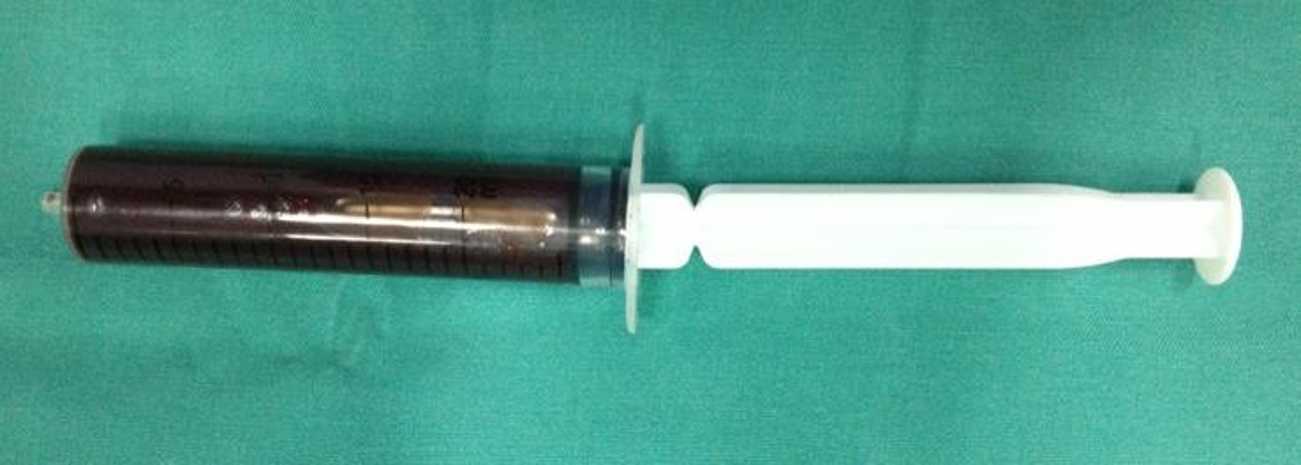 Dịch máu không đông