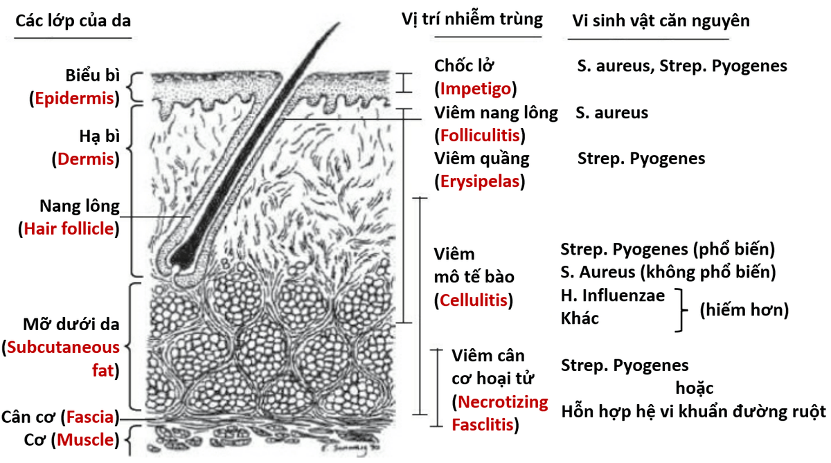 Nhiễm trùng da và mô mềm