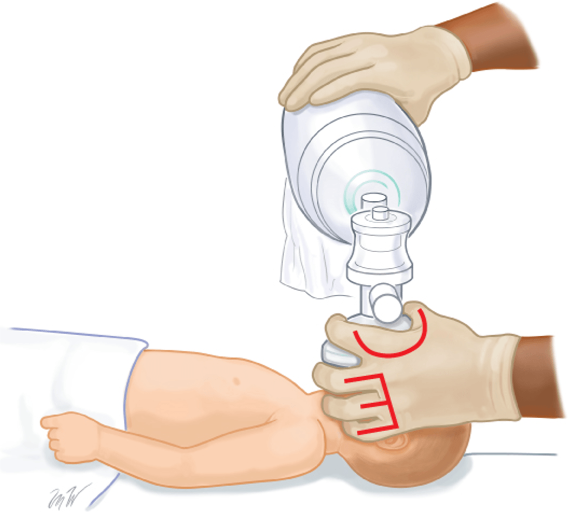 Kỹ thuật cầm Mask CE